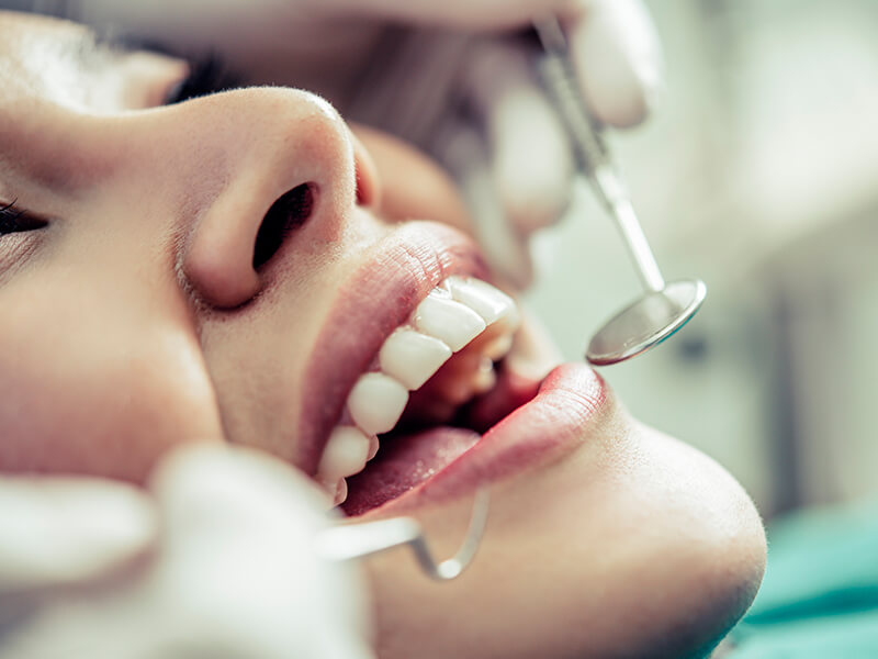 clareamento dental