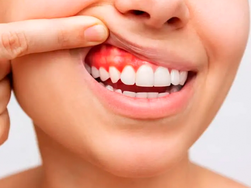 periodontia