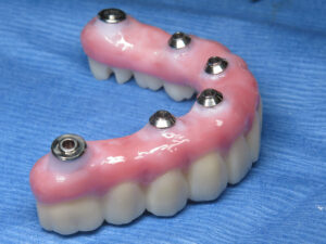 próteses dentárias