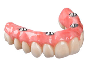 prótese dentária